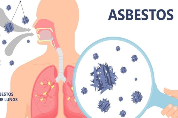 What You Should Understand About Asbestos and the Health Risks It Poses